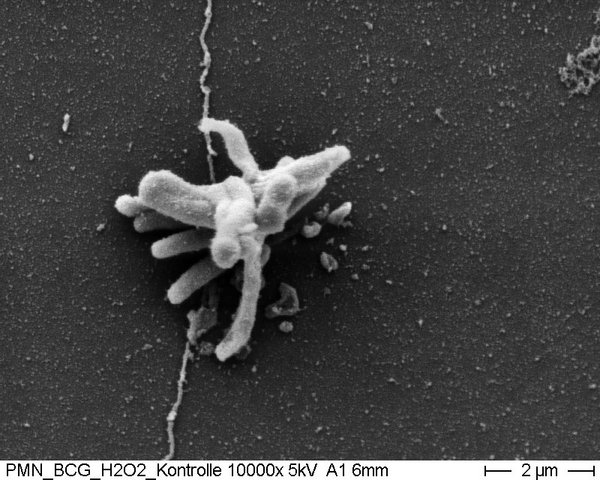 REM-Aufahme eines Aerosolpartikels aus Mykobakterien-Verbänden . Foto: Elisabeth Pfrommer, Heinrich-Pette-Institut / FZ Borstel 